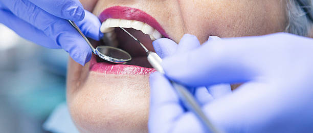 Best Emergency Treatment for Toothache in Lewisport, KY